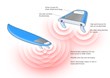 Shark Shield Awarded Government Grant for Surfboard Shark Deterrent
