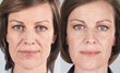 Bellava MedAesthetics & Plastic Surgery Center of Bedford Hills,...