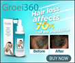 Groei360: The Clinically Proven Highly Effective Hair Loss Treatment...