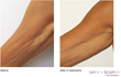 Lakes Dermatology, Las Vegas, Nevada Announces the Installation of...