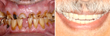 Oxnard Dentist’s Teaching Academy in India Starts This Month