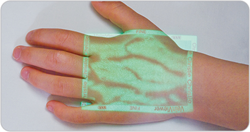 Christie Medical Holdings Earns New Innovative Technology Designation from Novation for VeinViewer Vascular Imaging System
