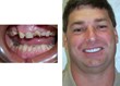 Dr. Ronald Receveur Adds In-house Laboratory, Lab Technician to...