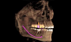 Dr. Ronald Receveur recently installed the Sirona Galileos 3D Dental Imaging System, which offers computerized axial tomography (CAT) scans of the jaw and mouth.