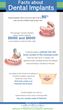 Louisville Dentists Says Denture Wearers Can Have Permanent Teeth...