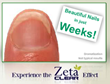 Special Packages of Zeta Clear Nail Fungus Treatment System Released