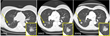 Kitware Receives Funding to Develop an Innovative Method for...