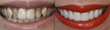 Exquisite Dentistry Celebrates Three Year Anniversary
