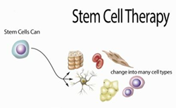 Stem Cell Therapy