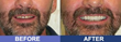 New Albany Cosmetic Dental Surgery can be Accomplished Without Pain,...