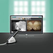 A Brilliant New Approach to Caries Detection is Now Available