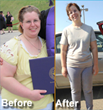 Successful Gastric Bypass Announced Today by Dr. Nilesh A. Patel...