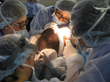 Los Angeles Hair Transplant Center Offers Affordable Hair Transplant...
