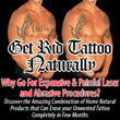 Get Rid Tattoo Naturally Review | How To Remove Tattoos Easily –...