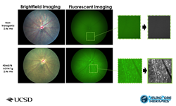 Brightfield and Fluorescent imaging of non transgenic and PDNG78 ASYN tg mice