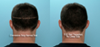 Connecticut Hair Transplant Surgeon Dr. Dana Brownell Selected as...