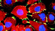 Study Recommends Limiting Actos Use Due to Increased Risk of Bladder...