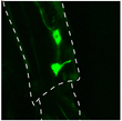 Stumbling Fruit Flies Lead Scientists to Discover Gene Essential for...