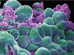 Actos: serious adverse events