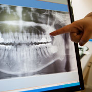 Dental Cone-beam Computed Tomography