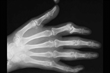 DigitalOne Reports Lets Radiology Centers Send Images Along With...