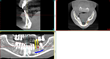 Ueno Periodontics Offers New Digital Dental Implant Procedure