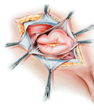 Dr. Raymond Leung, Hernia Specialist, Joins Healthpointe Teams in...