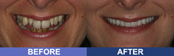 Dr. Ronald Receveur, provides services including crowns, dental implants, IV sedation, and teeth whitening and other Aesthetic dentistry.