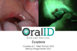 Philadelphia Periodontist Fights Oral Cancer with New Screening Tool