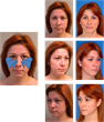 Artisan of Beauty Medical Practice Now Offering Fat Grafting As a...