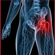 New DePuy Hip Implant Lawsuit Alleges Pain and Suffering: Now,...