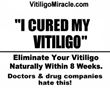 Vitiligo Miracle Review | How To Remove Vitiligo Safely And...