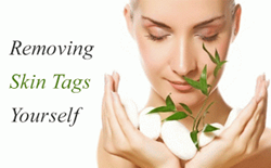 Revitol Skin Tag Remover