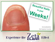 Zeta Clear For Healthy And Clear Nails, Now Available with 1 Extra...