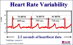 heart rate variability, heart rate monitors, heart rate watch company