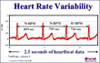 Heart Rate Monitors That Measure Variability Key Says New HRWC Study