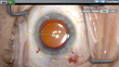 Leica Microsystems and TrueVision 3D Surgical Enter Agreement to...