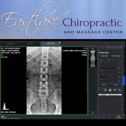 Seattle Chiropractor - Eastlake Chiropractic and Massage Center - Digital X-Rays