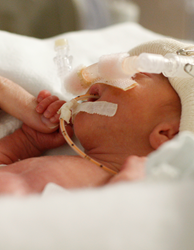 premature baby; preemie
