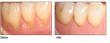 Top Periodontist Dr. Stephen Brown Brings Revolutionary Gum Recession...