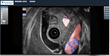 Remote Medical Technologies Announce iMedHD2™ Tele-Ultrasound System...