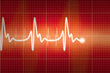 FDA Announces Class I Recall of Maquet Datascope Intra-Aortic Balloon...