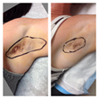Dr. Steven Weiner of The Aesthetic Clinique, Shows That Excessive...