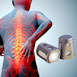 medtronic lawsuit