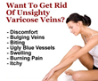 Varicose Veins Secrets Review – The Secrets To Fresh And Youthful...