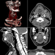 Telerad Tech’s - RADSpa Advance Viewer MPR/MIP/3D Gets an FDA...
