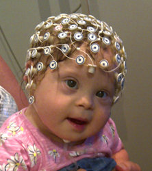 EEG equipment is used during an electrophsysiological assessment of a baby with Down's syndrome at Birkbeck's Babylab