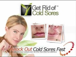 Get rid of cold sores fast review