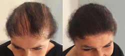 Boost n Blend Hair Thickening Fibres