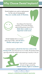 Why choose dental implants?